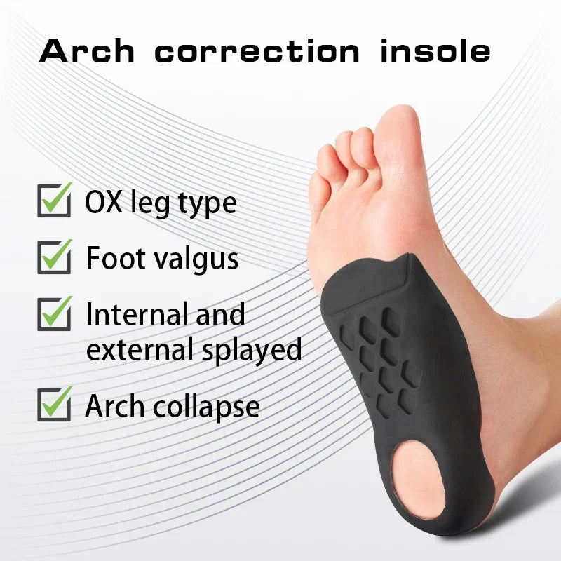 Orthopedic Arch Insoles – Flat Foot Support Inserts (Unisex)